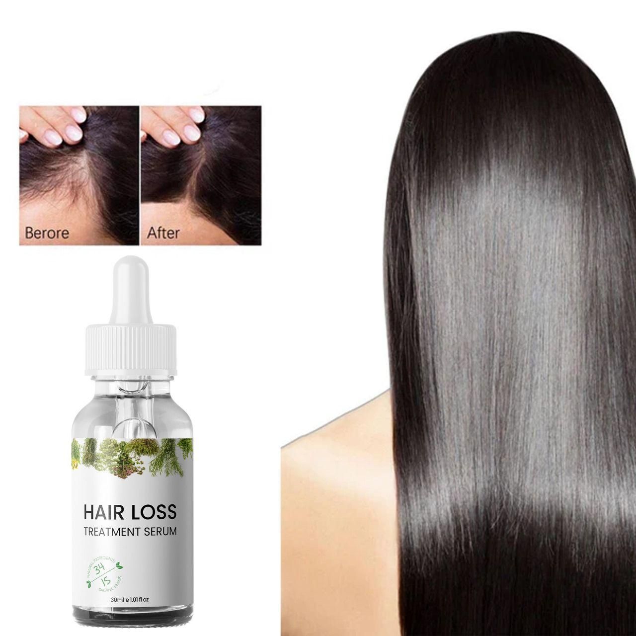 Hair Loss Treatment Serum 30ml (Pack of 2) – Boost Hair Growth & Strengthen Roots | NISHU Superstores