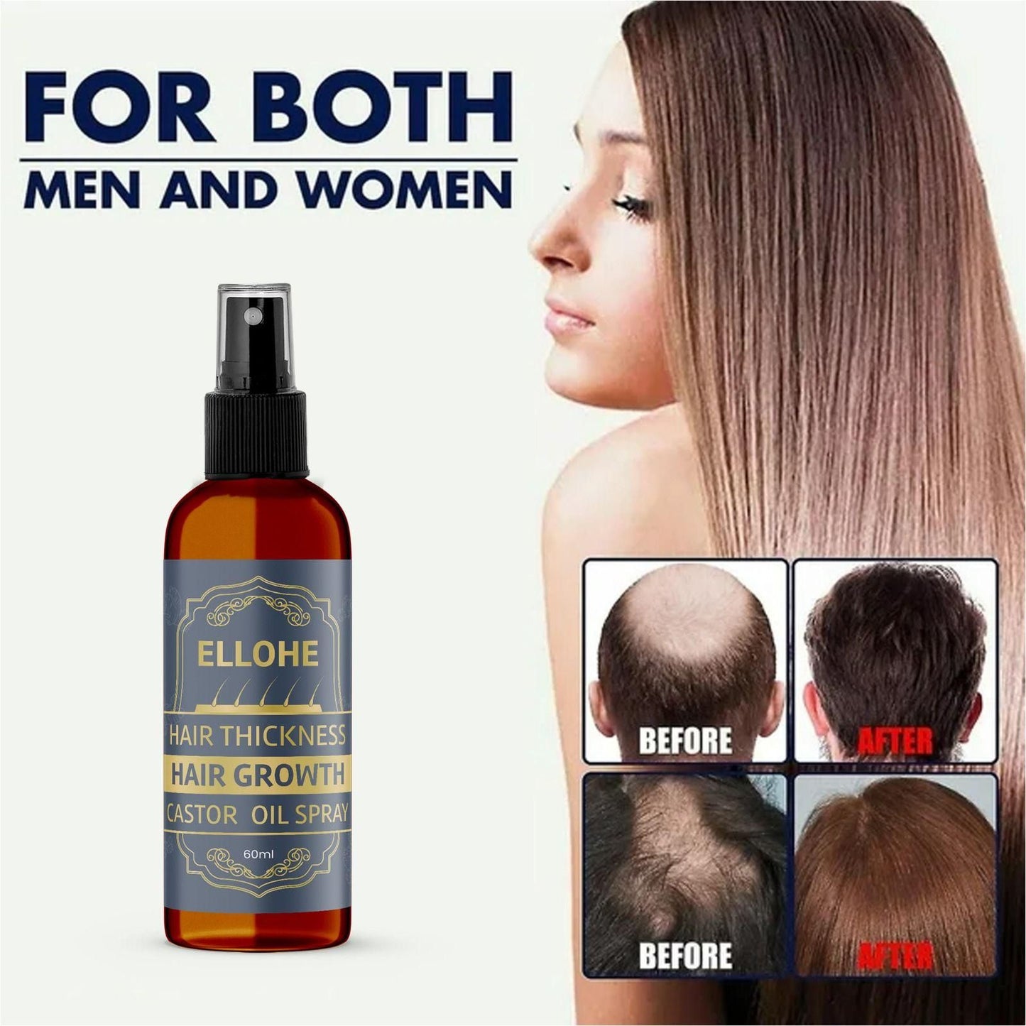 ELLOHE Hair Growth Castor Oil Spray – 60ml for Hair Thickness & Regrowth | NISHU Superstores