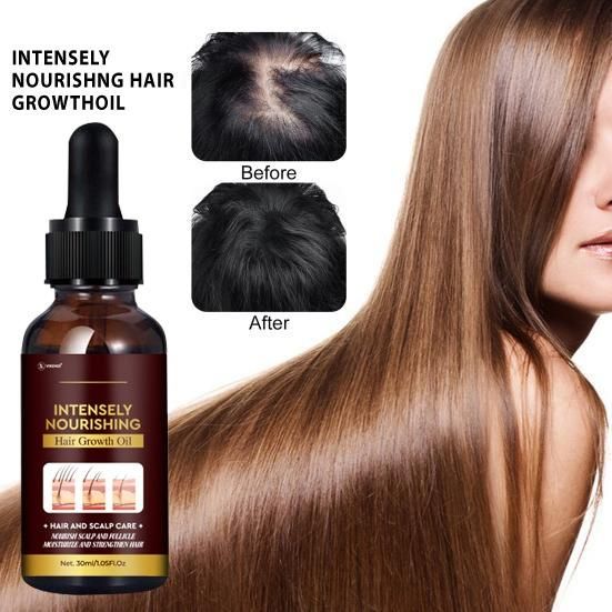 Intensely Nourishing Hair Growth Oil – 60ML (Pack of 2) | Boosts Growth & Reduces Hair Fall | NISHU Superstores
