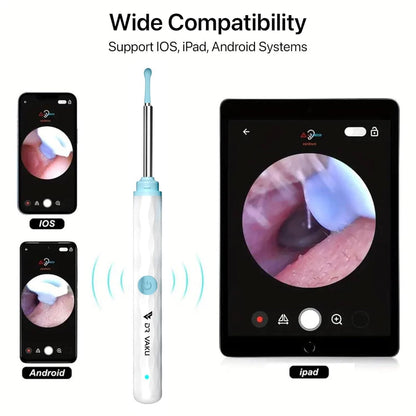Smart Visual Ear Wax Cleaner with Camera | Safe & Easy Ear Cleaning | NISHU Superstores