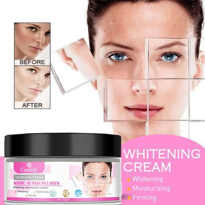 CASSIDY Kojic Acid & Collagen Whitening Cream 60gm – Brightening & Anti-Aging Skincare | NISHU Superstores