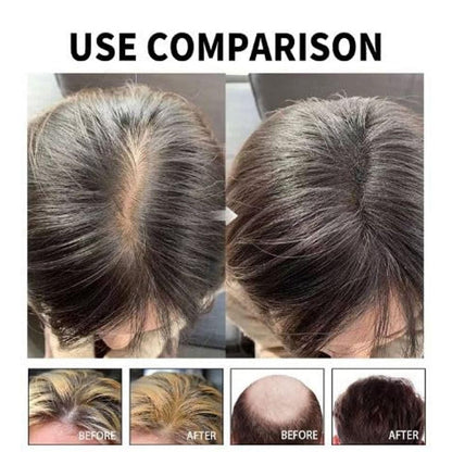 Hair Loss Treatment Serum 30ml (Pack of 2) – Boost Hair Growth & Strengthen Roots | NISHU Superstores