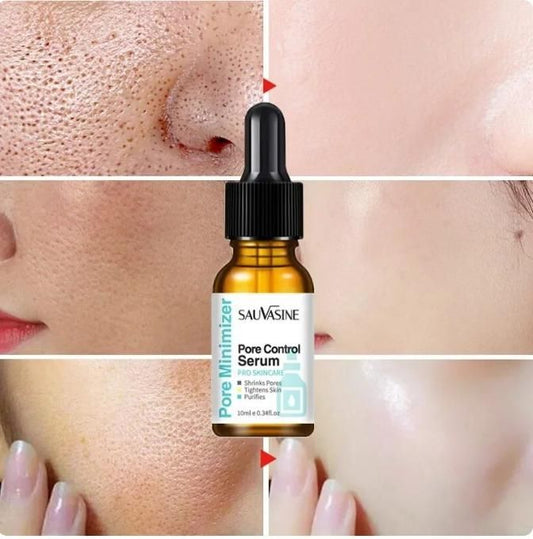Pore Shrinking Face Serum 30ml – Oil Control, Acne & Dark Spot Treatment | NISHU Superstores