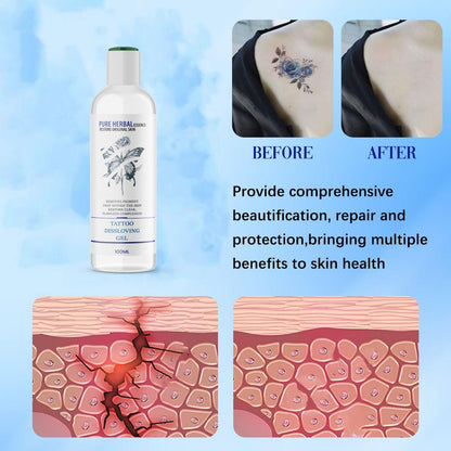 Tattoo Dissolving Gel 100ML (Pack of 2) – Effective & Safe Tattoo Removal | NISHU Superstores