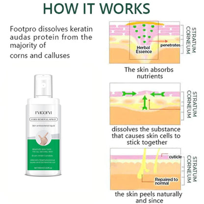 Corn Removal Spray 120ml (Pack of 2) – Fast & Effective Relief | NISHU Superstores