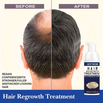 AEST NOOM Hair Regrowth Treatment – Extra Strength Formula 60ml | For Thicker, Fuller Hair | NISHU Superstores