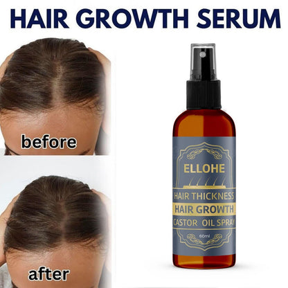 ELLOHE Hair Growth Castor Oil Spray – 120ml Pack of 2 for Hair Thickness & Regrowth | NISHU Superstores