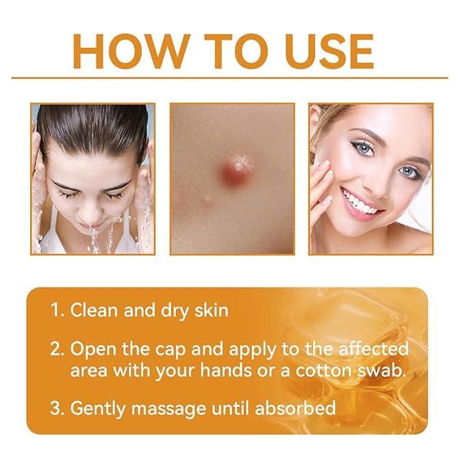 Bee Venom Skin Treatment Cream 100g (Pack of 2) – Anti-Acne, Anti-Aging & Skin Repair | NISHU Superstores