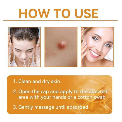 Bee Venom Skin Treatment Cream 100g (Pack of 2) – Anti-Acne, Anti-Aging & Skin Repair | NISHU Superstores