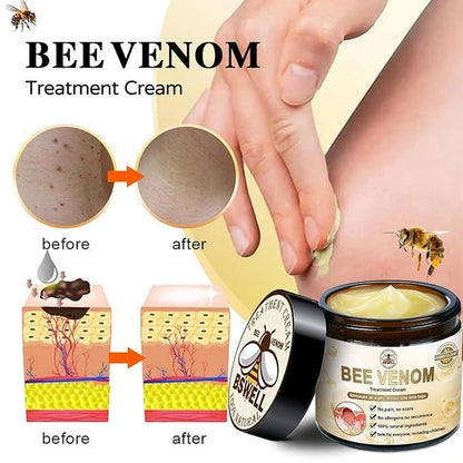 Bee Venom Skin Treatment Cream 100g (Pack of 2) – Anti-Acne, Anti-Aging & Skin Repair | NISHU Superstores