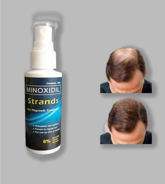 Minoxidil Topical Hair Growth Solution for Men 60ml – Regrow & Strengthen Hair | NISHU Superstores