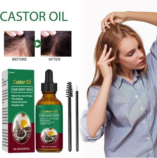 Castor Oil for Hair, Body & Skin (Pack of 1) – Pure & Natural Multipurpose Oil | NISHU Superstores