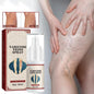 Vein Healing Varicose Veins Treatment Spray – Fast Relief for Leg Pain & Swelling | Pack of 1 | NISHU Superstores