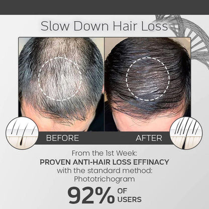 Esotery Shedd Stop Pro-Strength Hair Spray 100ml – Reduce Hair Fall & Strengthen Roots | NISHU Superstores